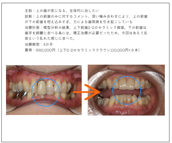 MYデンタル審美歯科
