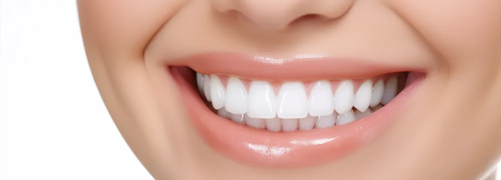 ホワイトニング治療のイメージ