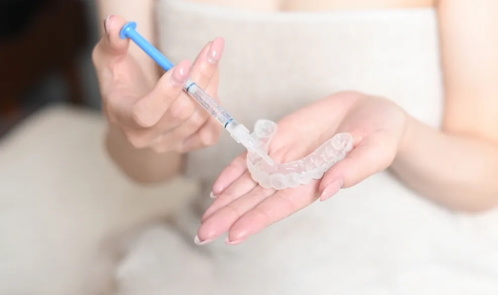 ホームホワイトニングの施術イメージ