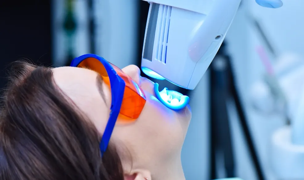 オフィスホワイトニングの施術イメージ