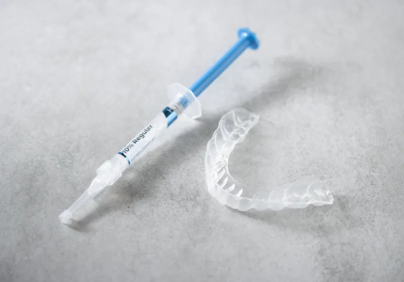 ホームホワイトニングの流れ3 マウスピースの作製