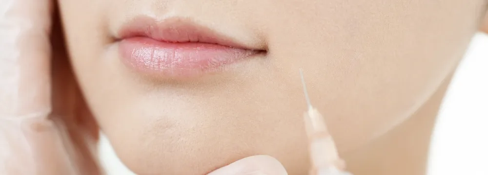 ボツリヌストキシン治療のイメージ