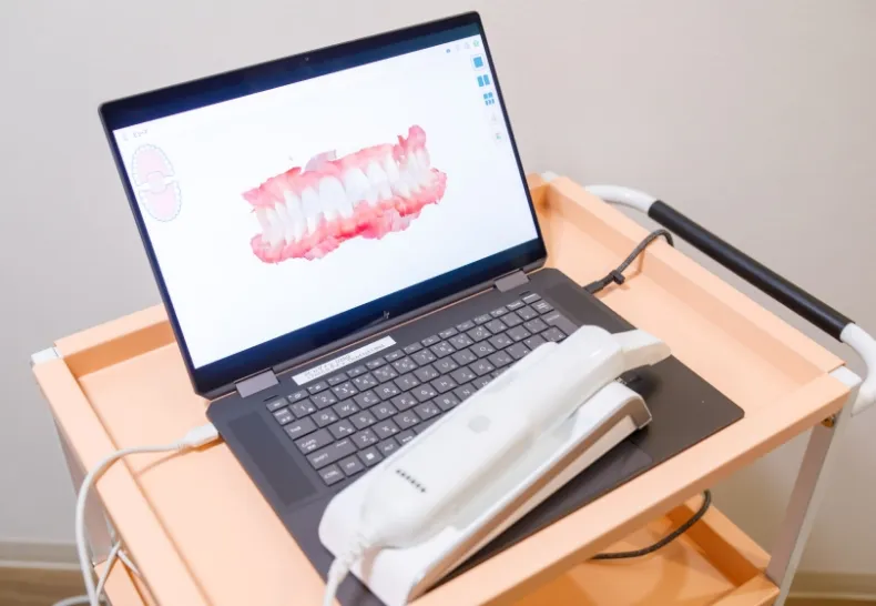 口腔内スキャナー