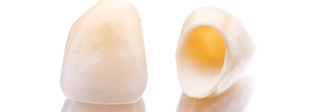 自然に輝くセラミック治療