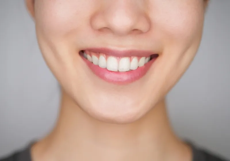 最終補綴物の作製・装着と咬合調整画像