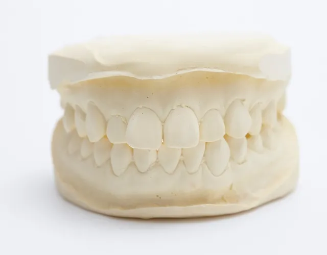 噛み合わせ治療画像