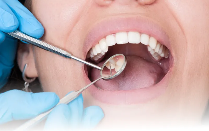 全顎治療・咬合治療の個別カウンセリングのイメージ