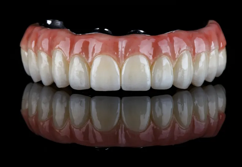 入れ歯 マグネットデンチャー