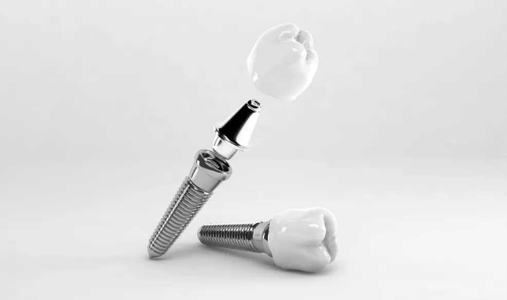 【良質なインプラント】信頼性の高いインプラントメーカーの採用(DIOインプラント)