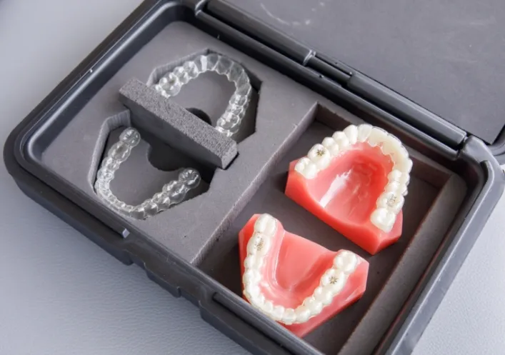 マウスピース矯正