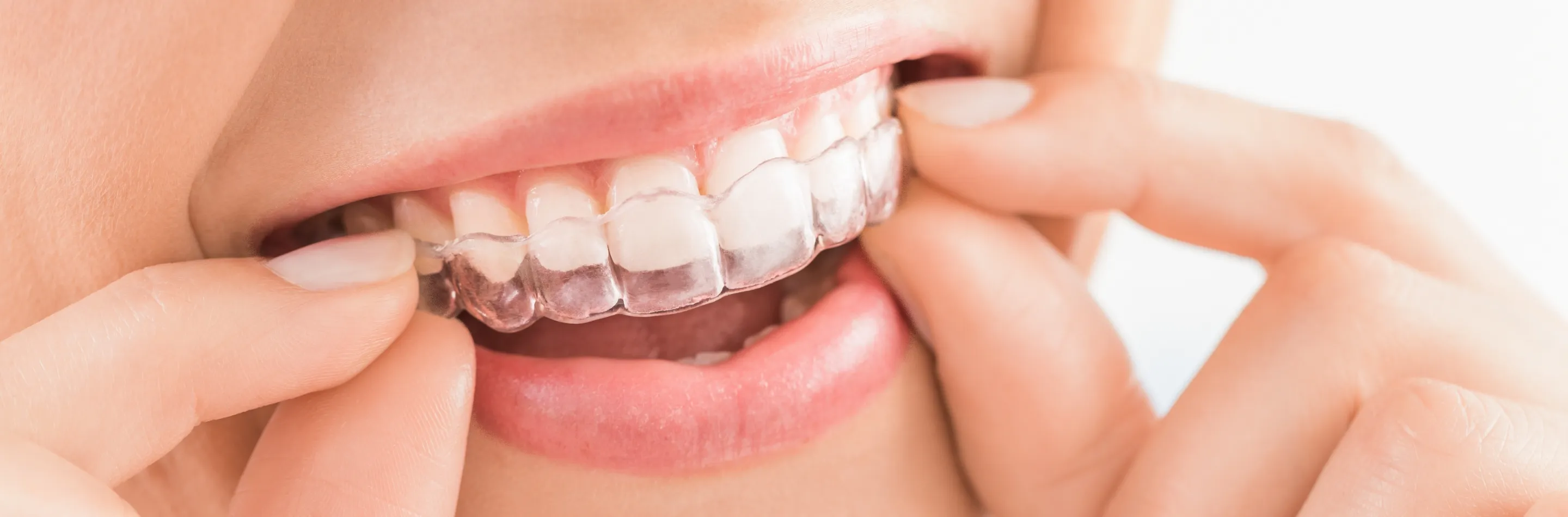 矯正治療のキービジュアル