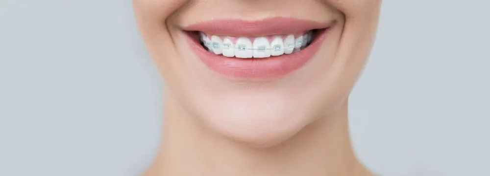 成人矯正のイメージ