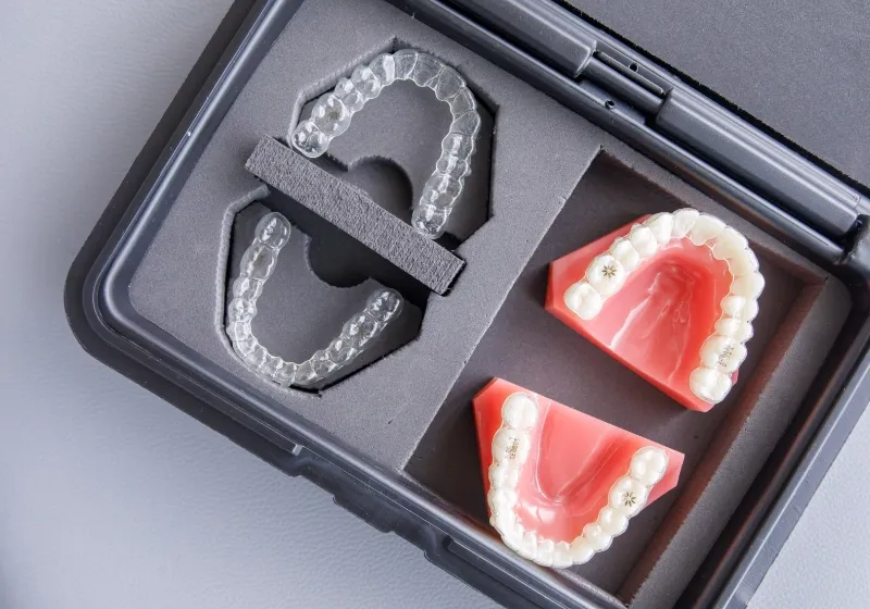 マウスピース矯正のイメージ