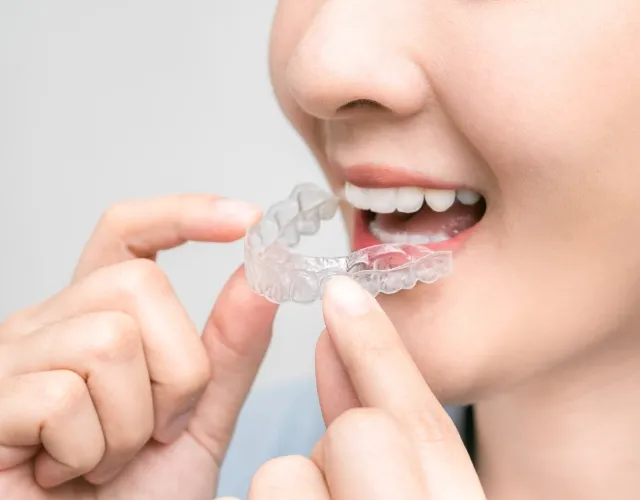 マウスピース型矯正装置の特長2 取り外しができる