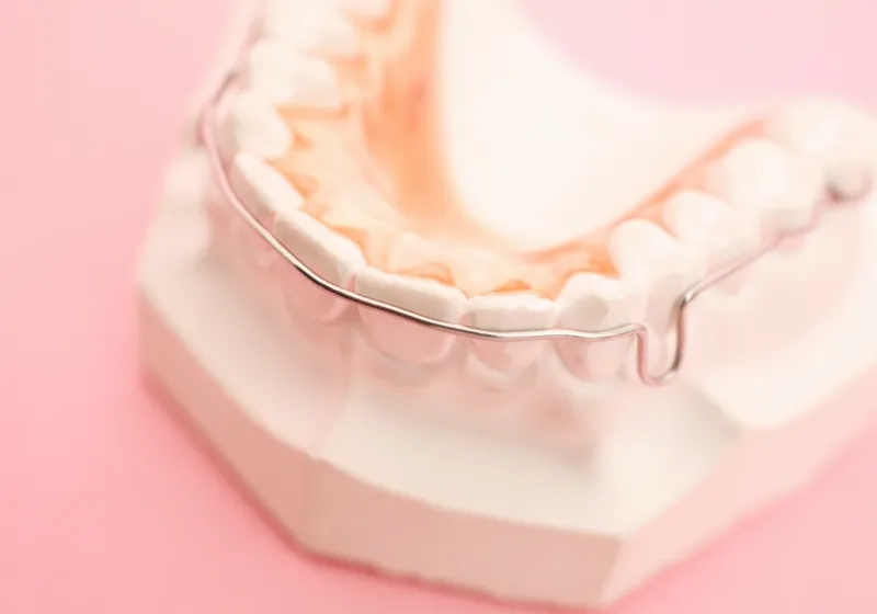 矯正治療の流れ7 保定メンテナンス