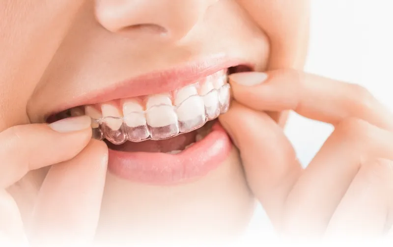 矯正無料相談案内のイメージ