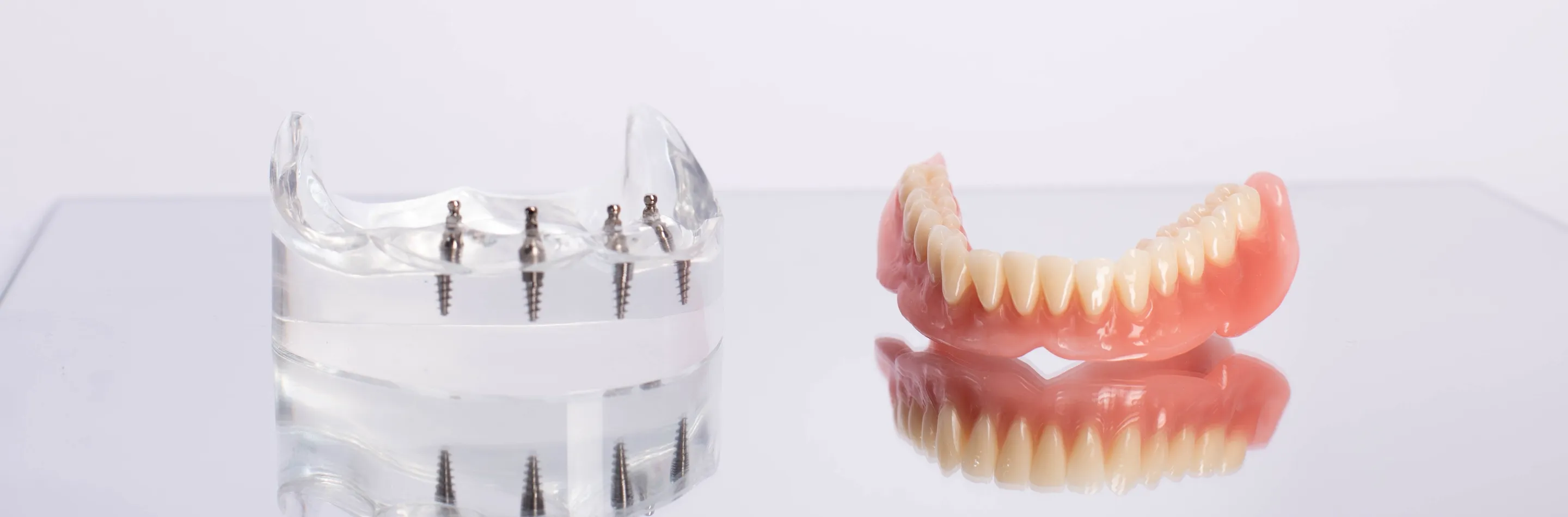 インプラントオーバーデンチャー/オールオン46のキービジュアル