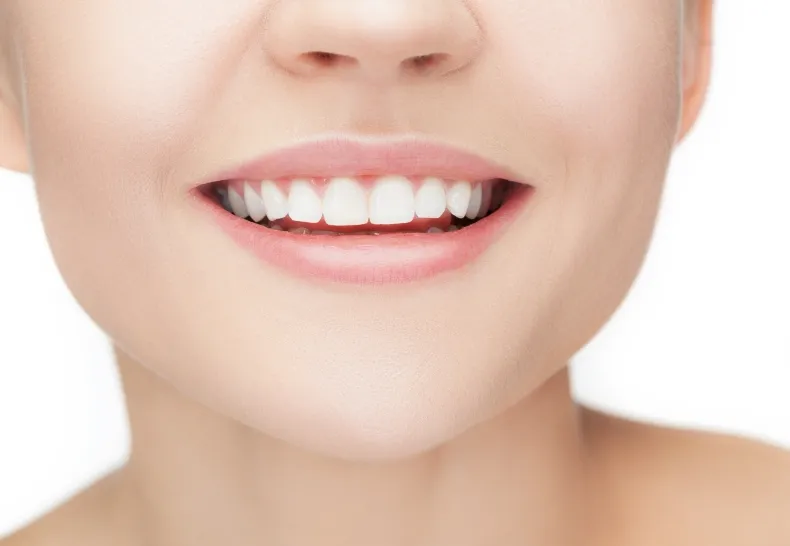 治療の流れ5 装着最終調整