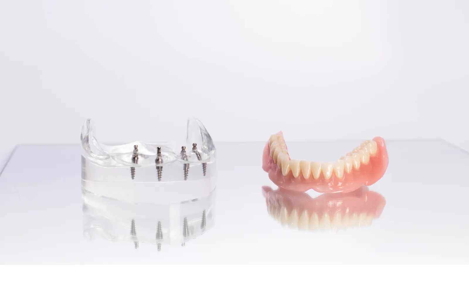 インプラントオーバーデンチャー、オールオン4・6のご相談のイメージ