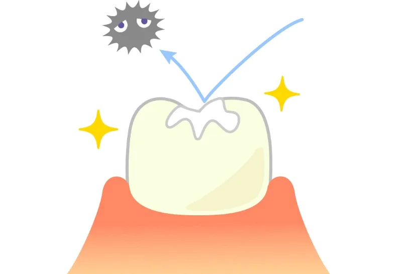 虫歯の治療のイメージ