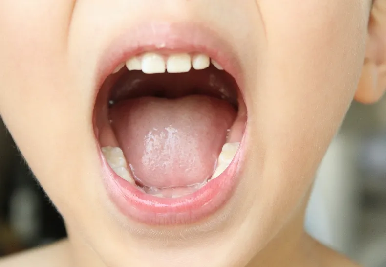 MFT(口腔筋機能療法)のイメージ