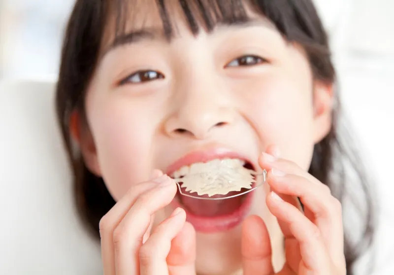 小児矯正の流れ4