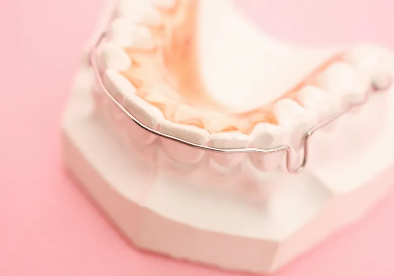 小児矯正の流れ6