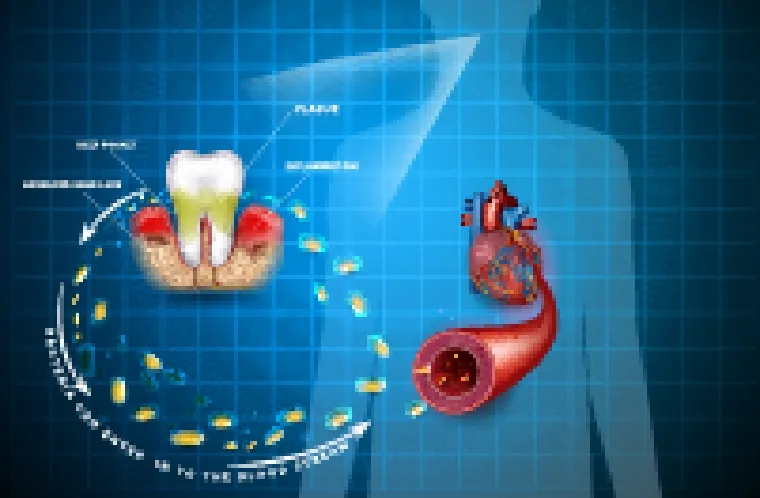 歯周病と全身疾患の関連性のイメージ