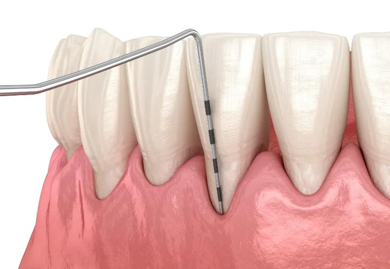 プロービング検査のイメージ