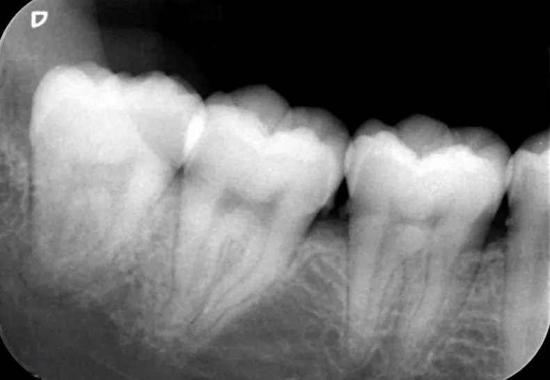 レントゲン検査のイメージ