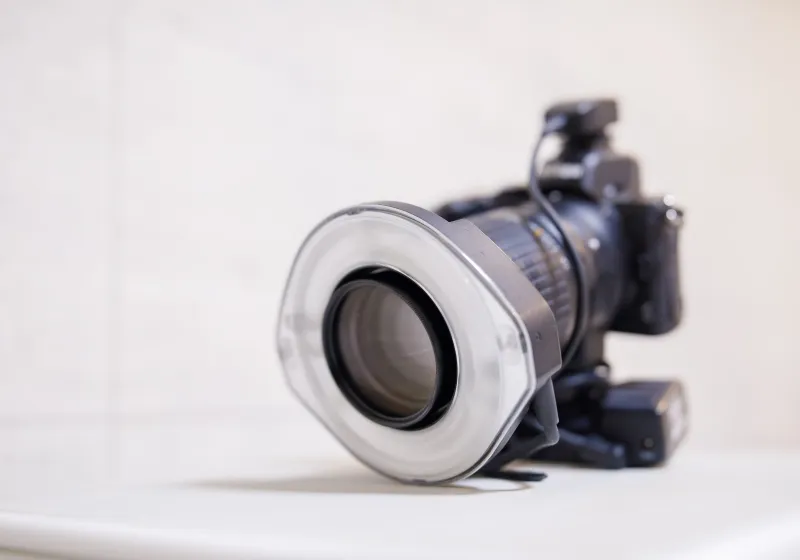 口腔内写真の撮影のイメージ