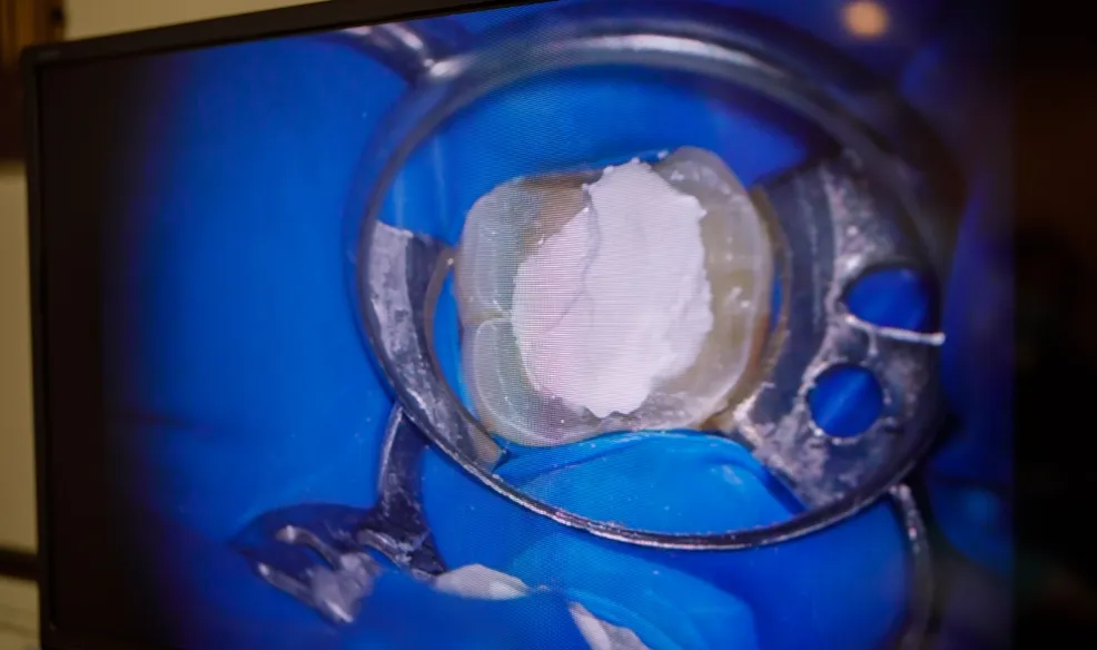 ラバーダム防湿のイメージ